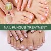 EELHOE Nail Care Solution For Nail Surface Thick Nails Soft Nails Gentle Cleansing And Moisturizing Solution