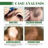 Hoegoa Hair Growth Essential Oil Moisturizes and Smoothes Hair Repairing Roots and Strengthening Hair Care Batana Secret Hair Essential Oil