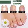 EELHOE Nail Care Solution For Nail Surface Thick Nails Soft Nails Gentle Cleansing And Moisturizing Solution
