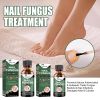 EELHOE Nail Care Solution For Nail Surface Thick Nails Soft Nails Gentle Cleansing And Moisturizing Solution